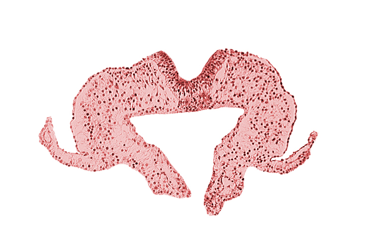 midgut, neural fold, neural groove, primordial lateral body fold, surface ectoderm