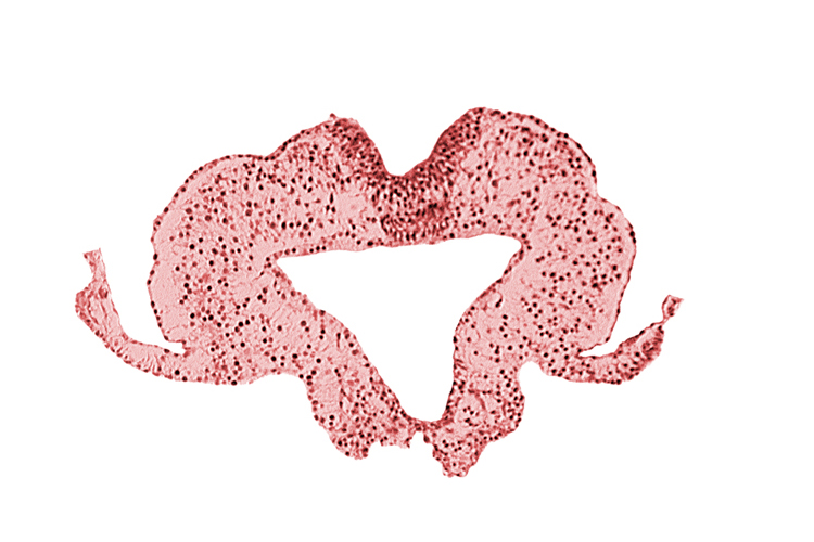 caudal intestinal portal, endoderm, transition region between notochordal plate and gastrulation streak