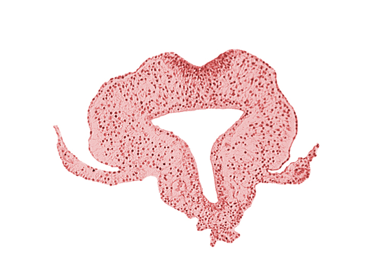 allantoic primordium, amnion attachment, amniotic cavity, extra-embryonic coelom, gastrulation (primitive) streak, hindgut, left umbilical vein, neural plate, primordial lateral body fold