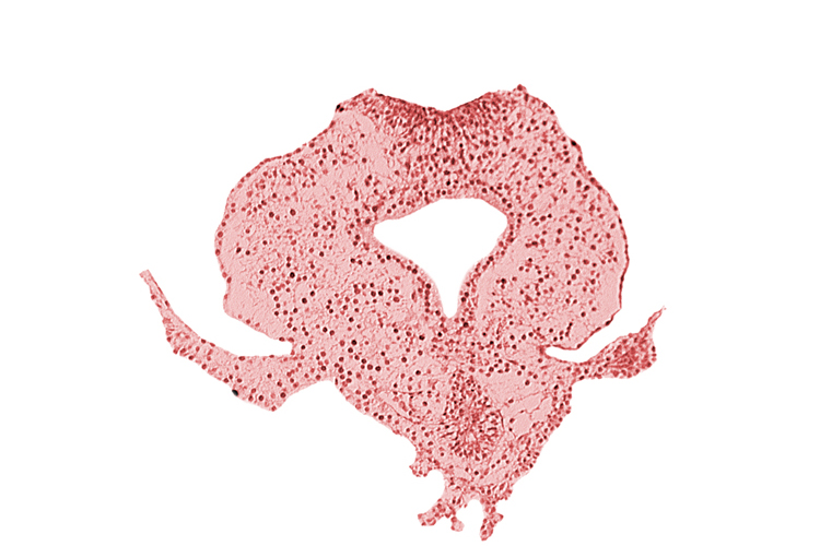 allantoic primordium, body stalk, gastrulation (primitive) streak, hindgut, neural plate, right umbilical vein, tail fold region