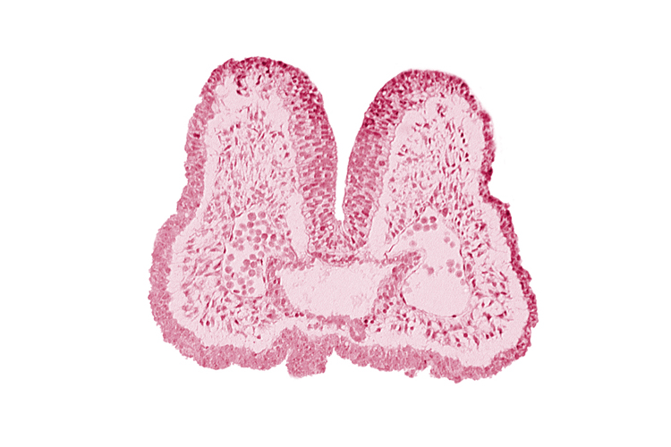 aortic arch 1, artifact space(s), cephalic edge of pharyngeal pouch 1, endoderm, foregut, mandibular prominence of pharyngeal arch 1, mesencephalic neural crest, neural fold [mesencephalon (M)], stomodeum