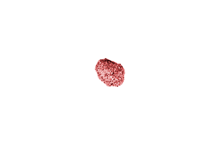 caudal part of caudal eminence