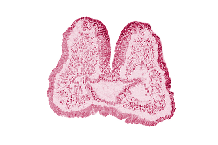 aortic arch 1, cephalic part of pharyngeal pouch 1, facio-vestibulocochlear neural crest (CN VII and CN VIII), foregut, mandibular prominence of pharyngeal arch 1, neural fold [rhombencephalon (Rh. A)], neural groove, notochordal plate, stomodeum