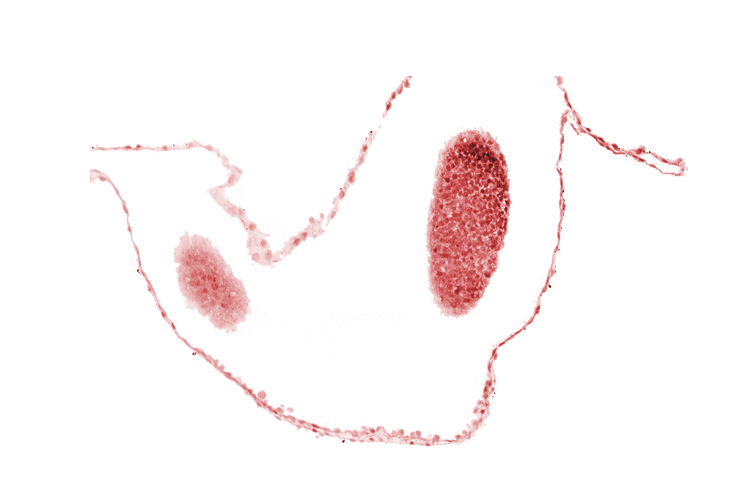 cephalic edge of left neural fold (primordial diencephalon), cephalic part of left neural fold (primordial diencephalon)