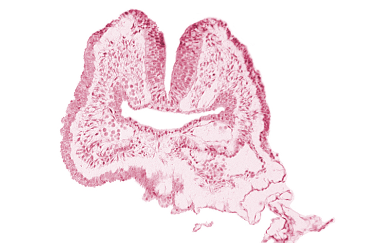 amnion, aortic arch 1, cephalic neuropore, dorsal aorta, endoderm, facio-vestibulocochlear neural crest (CN VII and CN VIII), floor of foregut, head fold region, neural fold [rhombencephalon (Rh. A)], pericardial cavity, pharyngeal pouch 1, surface ectoderm