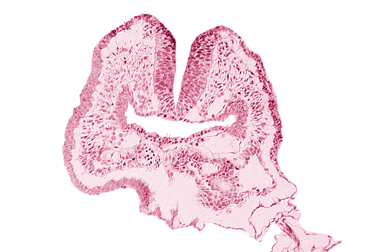 amnion, amnion attachment, aortic arch 1, cephalic neuropore, dorsal aorta, endoderm, facio-vestibulocochlear neural crest (CN VII and CN VIII), floor of foregut, head fold region, neural fold [rhombencephalon (Rh. A)], pericardial cavity, pharyngeal pouch 1, surface ectoderm