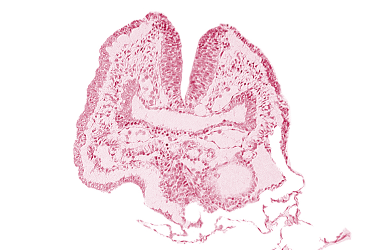 amnion, aortic arch 1, cephalic neuropore, dorsal aorta, facio-vestibulocochlear neural crest (CN VII and CN VIII), head fold region, neural fold [rhombencephalon (Rh. A)], pericardial cavity, pharyngeal pouch 1, pharyngeal pouch 1 endoderm: dorsal part, pharyngeal pouch 1 endoderm: ventral part
