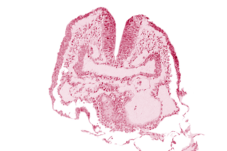 amnion, aortic arch 1, cephalic neuropore, dorsal aorta, facio-vestibulocochlear neural crest (CN VII and CN VIII), head fold region, neural fold [rhombencephalon (Rh. A)], pericardial cavity, pharyngeal pouch 1, pharyngeal pouch 1 endoderm: dorsal part, pharyngeal pouch 1 endoderm: ventral part