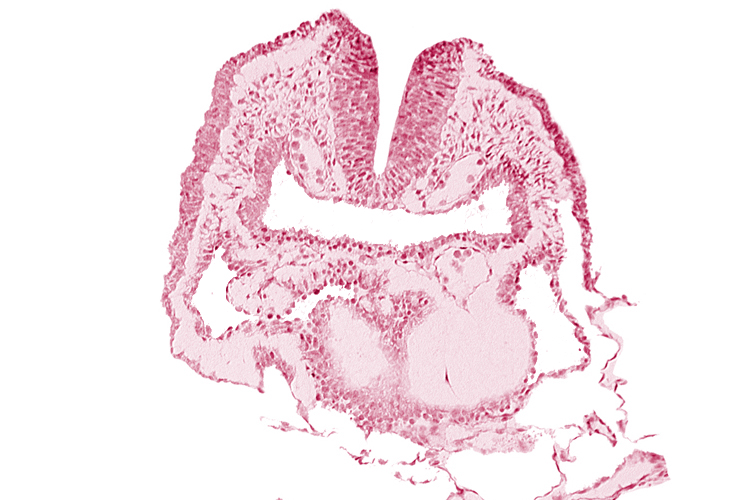 amnion, aortic arch 1, dorsal aorta, head fold region, neural fold [rhombencephalon (Rh. A)], pericardial cavity, pharyngeal pouch 1