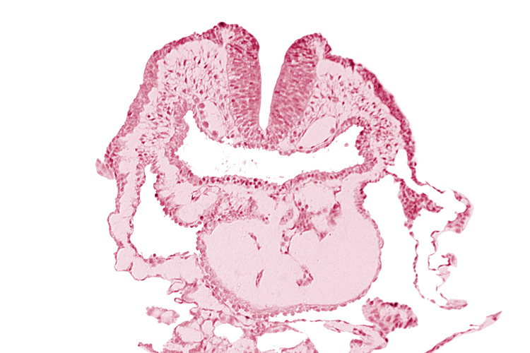 amnion, aortic arch 1, cephalic neuropore, conotruncus, dorsal aorta, head mesenchyme, neural fold [rhombencephalon (Rh. A)], pericardial cavity, pharyngeal pouch 1, pharyngeal pouch 1 endoderm: dorsal part, pharyngeal pouch 1 endoderm: ventral part