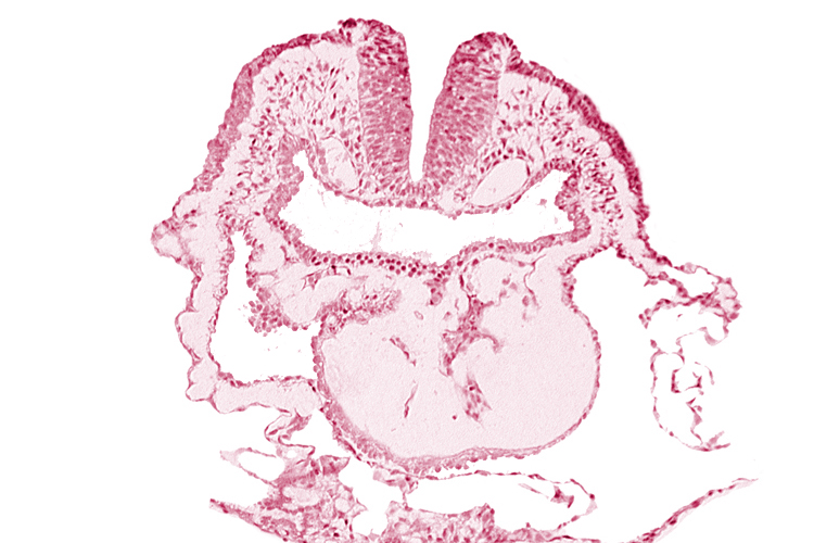 aortic arch 1, cephalic neuropore, conotruncus, dorsal aorta, head fold region, head mesenchyme, neural fold [rhombencephalon (Rh. A)], pericardial cavity, pharyngeal pouch 1, pharyngeal pouch 1 endoderm: dorsal part, pharyngeal pouch 1 endoderm: ventral part