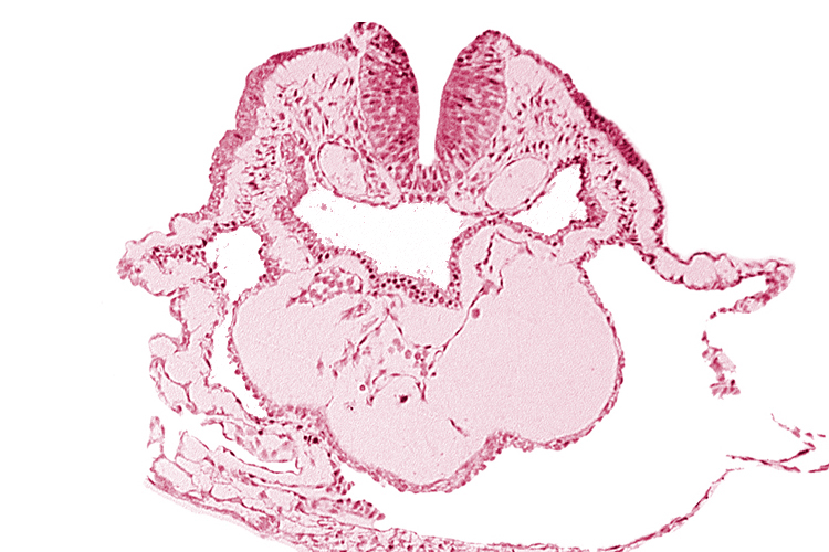 aortic arch 1, cardiac jelly, conotruncus, dorsal aorta, epimyocardium, lateral pharyngeal recess, left bulboventricular sulcus, neural fold [rhombencephalon (Rh. A)], pericardial cavity, thyroid gland primordium