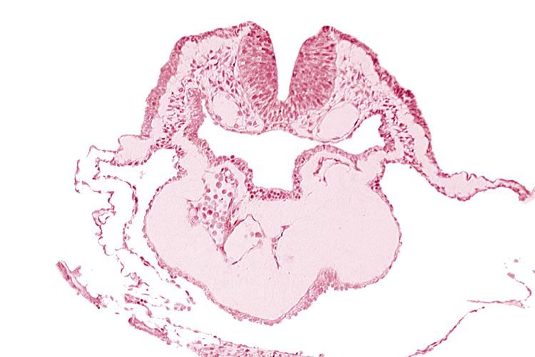 artifact separation(s), bulbis cordis, caudal edge of aortic arch 1, dorsal aorta, epimyocardium, lateral pharyngeal recess, left bulboventricular sulcus, looped heart, neural fold [rhombencephalon (Rh. B)], notochordal plate