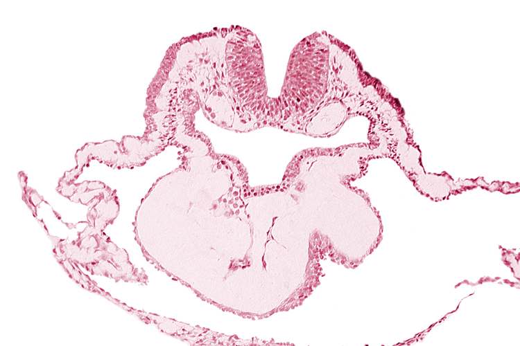 artifact separation(s), bulbis cordis, dorsal aorta, lateral pharyngeal recess, left bulboventricular sulcus, neural fold [rhombencephalon (Rh. B)], notochordal plate, pericardial cavity, presumptive right ventricle
