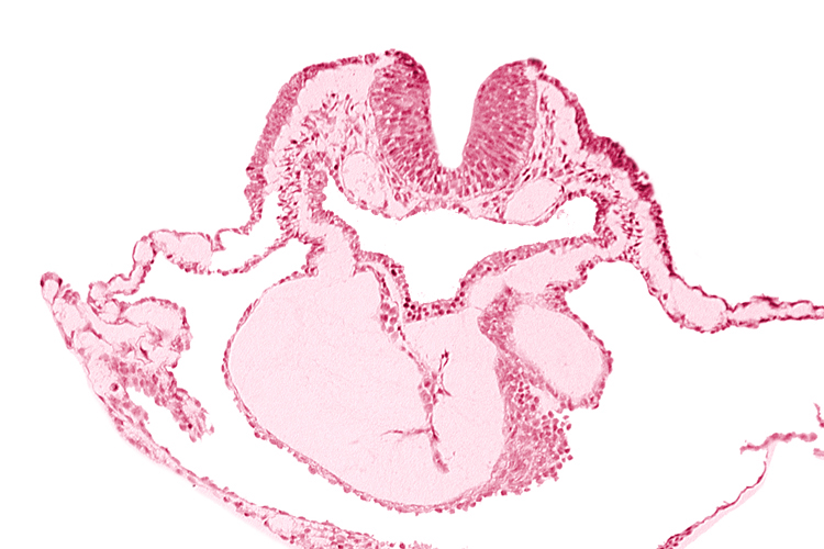 artifact separation(s), bulbis cordis, dorsal aorta, lateral pharyngeal recess, left bulboventricular sulcus, neural fold [rhombencephalon (Rh. B)], notochordal plate, pericardial cavity, presumptive left ventricle, presumptive right ventricle