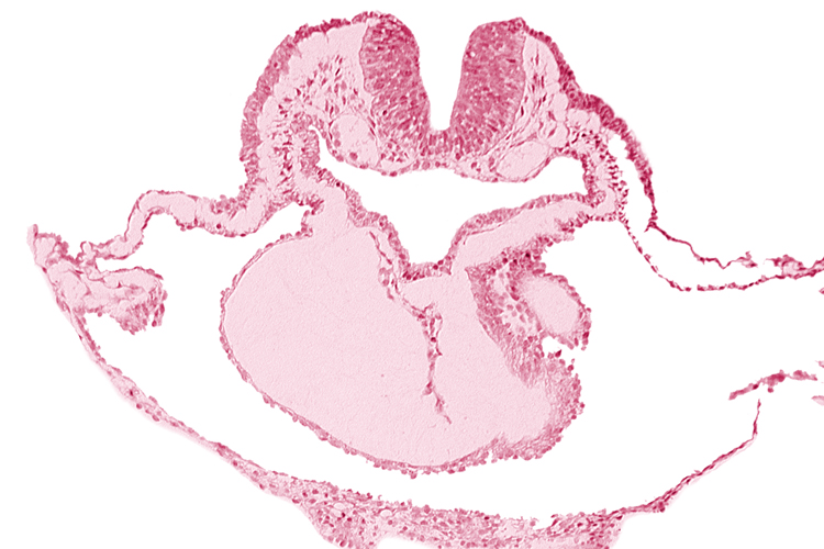 alar plate(s), artifact separation(s), basal plate, bulbis cordis, lateral pharyngeal recess, left bulboventricular sulcus, looped heart, neural fold [rhombencephalon (Rh. B)], notochordal plate, pericardial cavity, presumptive left ventricle, presumptive right ventricle, sulcus limitans