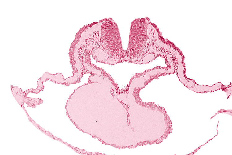 artifact separation(s), cardiac jelly, cephalic neuropore, dorsal aorta, lateral pharyngeal recess, neural fold [rhombencephalon (Rh. B)], pericardial cavity, presumptive left ventricle