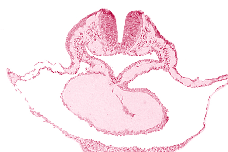 bulbis cordis, cardiac jelly, cephalic neuropore, dorsal aorta, lateral pharyngeal recess, median pharyngeal groove, neural fold [rhombencephalon (Rh. B)], pericardial cavity, presumptive left ventricle