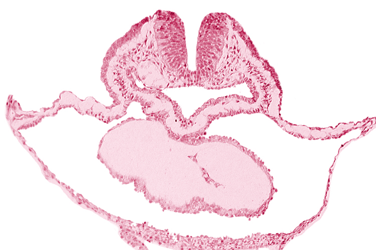 cephalic neuropore, dorsal aorta, lateral pharyngeal recess, median pharyngeal groove, neural fold [rhombencephalon (Rh. B)], pericardial cavity, presumptive left ventricle, right bulboventricular sulcus