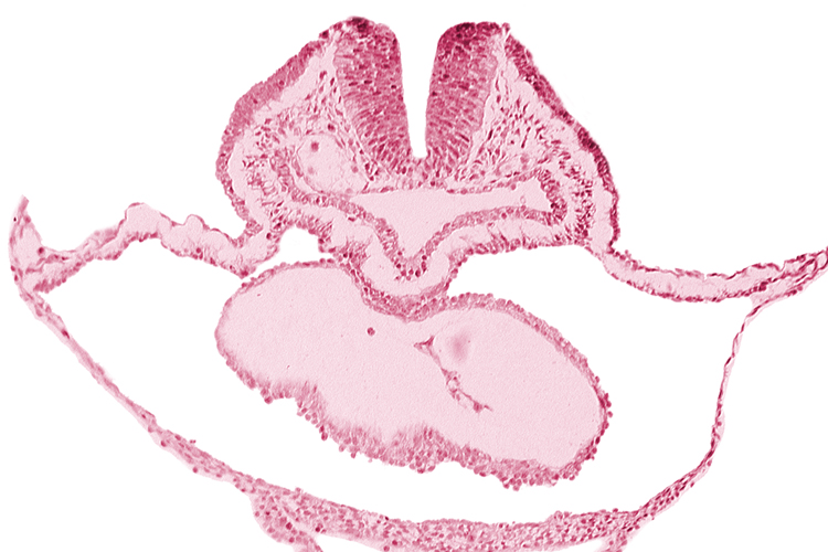 cephalic neuropore, dorsal aorta, lateral pharyngeal recess, median pharyngeal groove, neural fold [rhombencephalon (Rh. B)], pericardial cavity, presumptive left ventricle, right bulboventricular sulcus