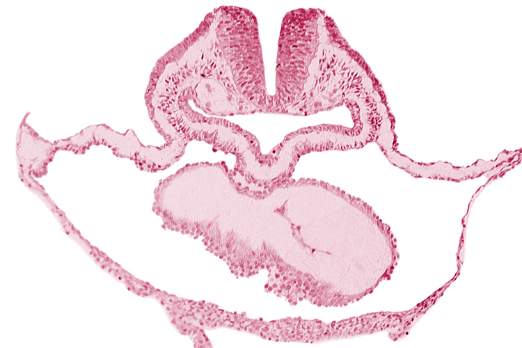 cephalic edge of otic placode, lateral pharyngeal recess, neural fold [rhombencephalon (Rh. B)], pericardial cavity, pericardial sac, presumptive left ventricle