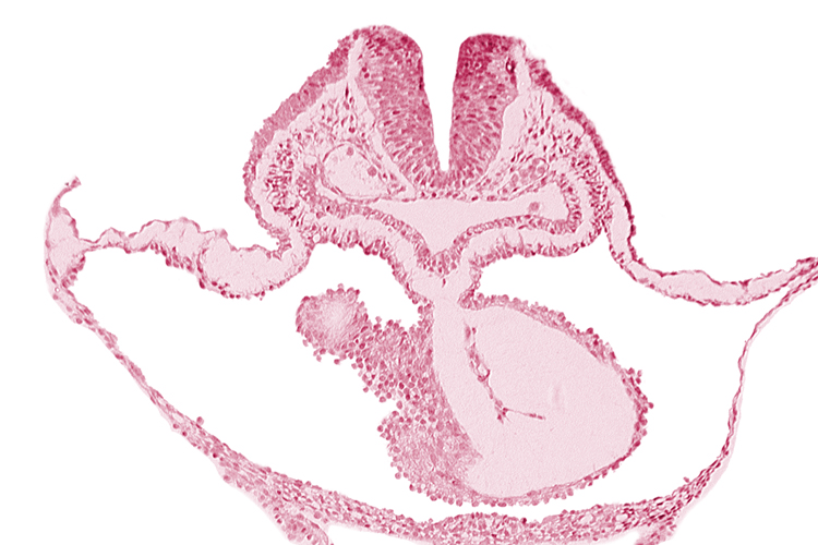 cephalic neuropore, epimyocardium, laryngotracheal sulcus, lateral pharyngeal recess, mesocardium, neural fold [rhombencephalon (Rh. B)], notochordal plate, otic placode, pericardial cavity, presumptive left ventricle