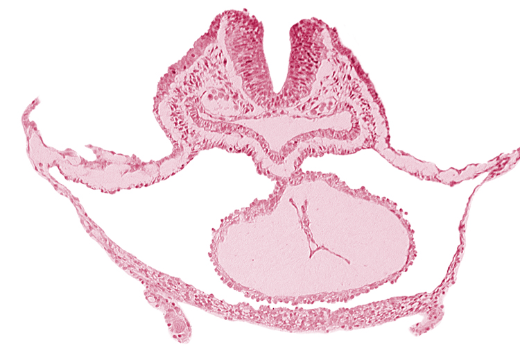 cardiac jelly, epimyocardium, laryngotracheal sulcus, lateral pharyngeal recess, mesocardium, neural fold [rhombencephalon (Rh. B)], otic placode, pericardial cavity, presumptive left ventricle, sulcus limitans