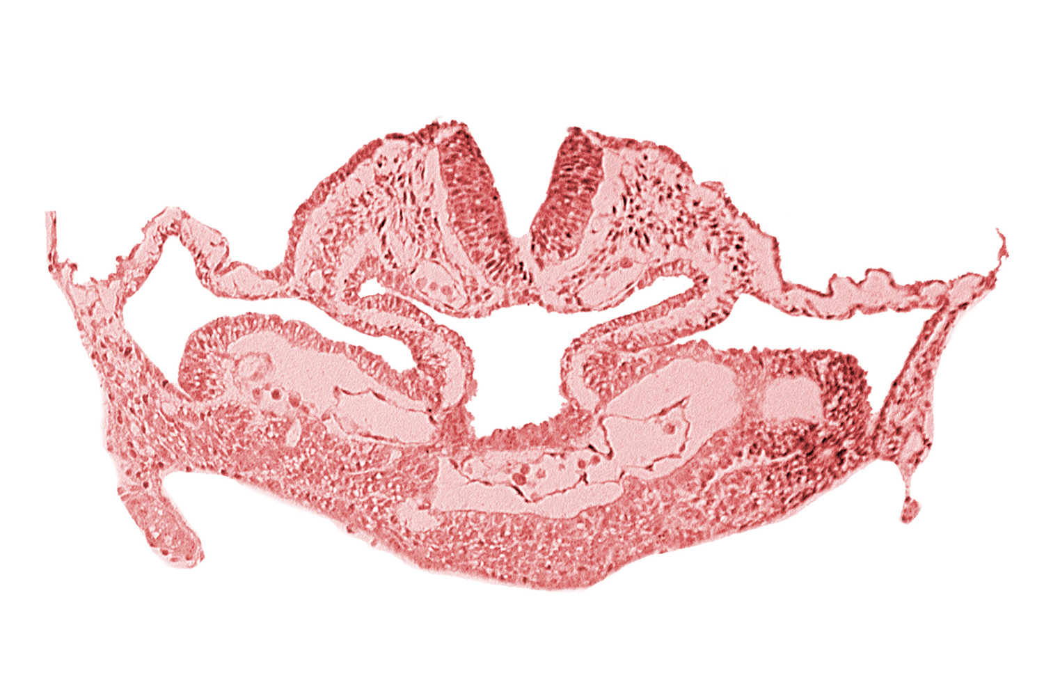 amnion attachment, atrial canal, cephalic neuropore, foregut, hepatic plate, neural fold [rhombencephalon (Rh. C)], presumptive left atrium, presumptive right atrium, primordial pericardioperitoneal canal (pleural cavity), septum transversum, surface ectoderm