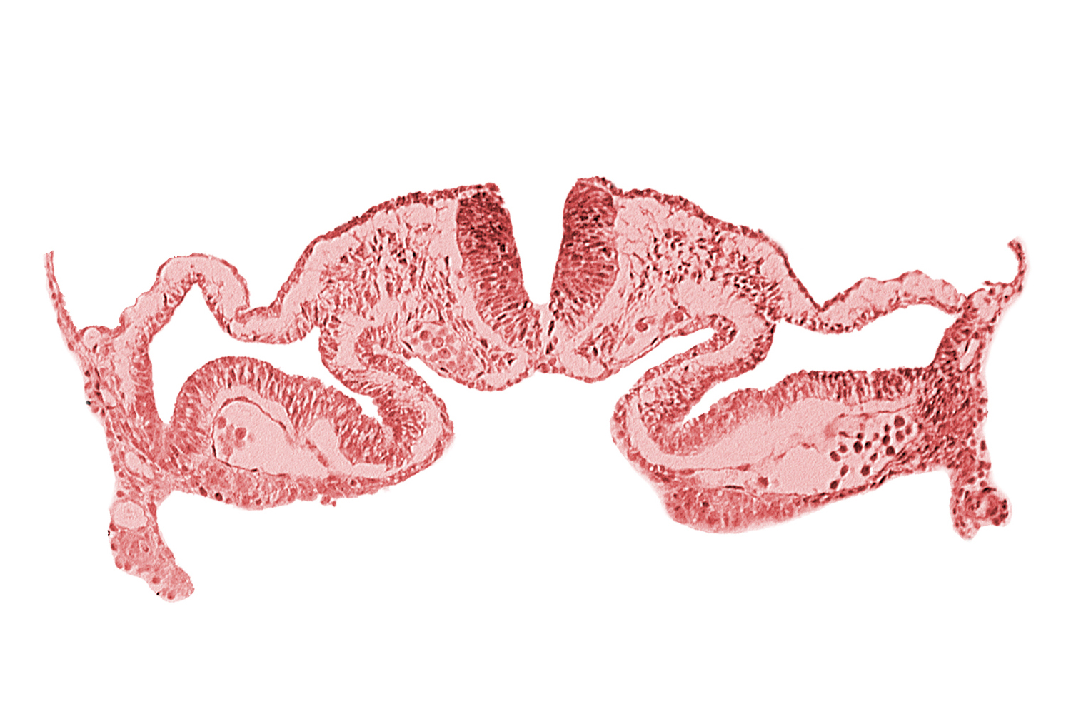 amnion attachment, amniotic cavity, artifact separation(s), midgut, presumptive right atrium, primordial pericardioperitoneal canal (pleural cavity), surface ectoderm, umbilical vesicle cavity