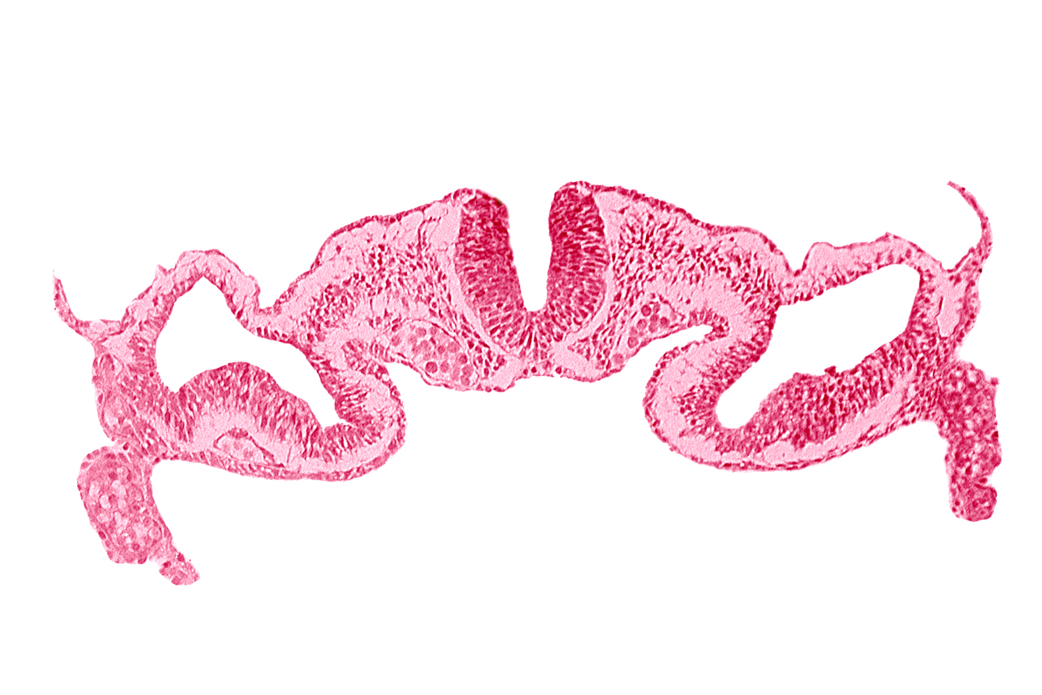 midgut, presumptive right atrium, primordial peritoneal cavity, surface ectoderm, umbilical vesicle cavity