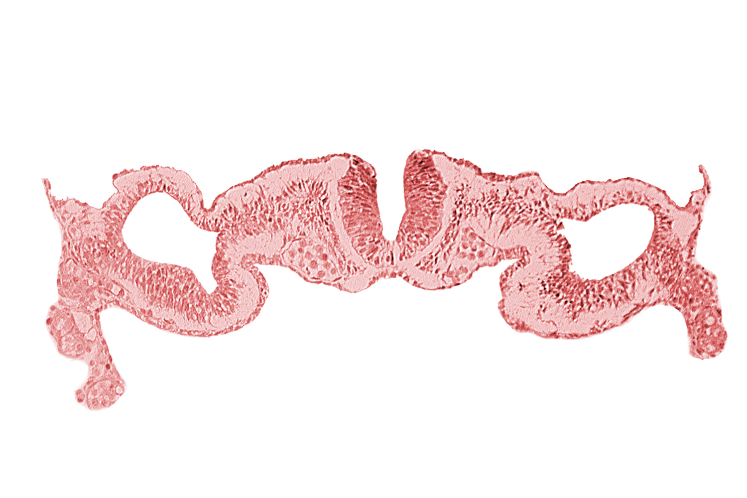 alar plate(s), basal plate, dorsal aorta, dorsal intersegmental artery, midgut, primordial peritoneal cavity, sulcus limitans, umbilical vesicle wall