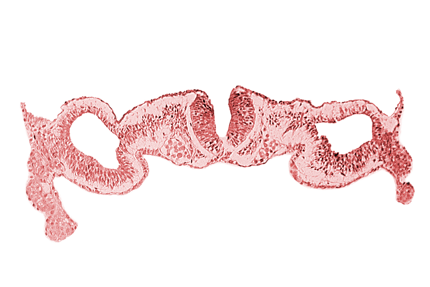 amnion attachment, dorsal aorta, dorsal intersegmental artery, midgut, neural fold [rhombencephalon (Rh. C)], primordial peritoneal cavity, sulcus limitans, surface ectoderm, umbilical vesicle wall