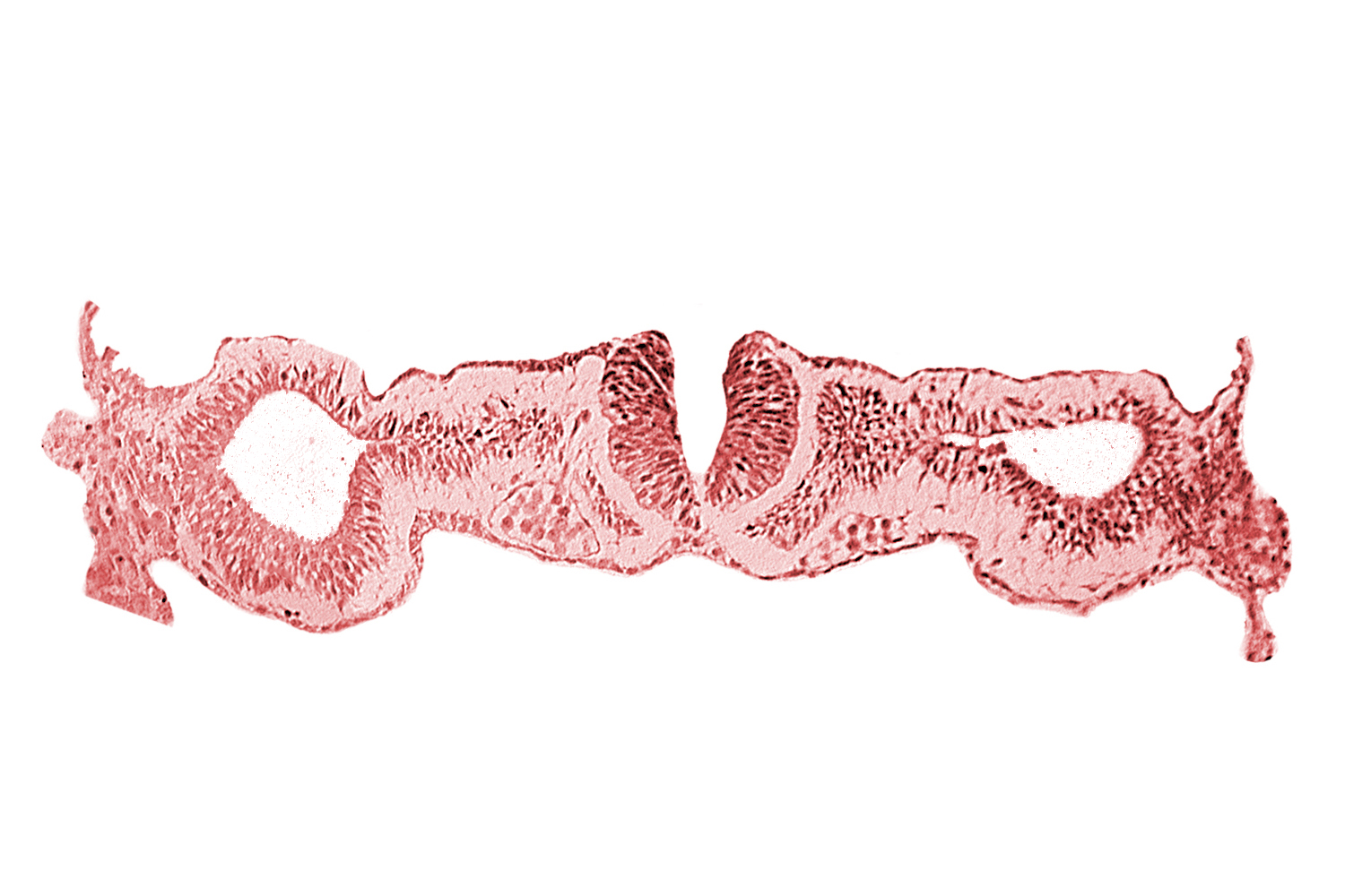 cephalic neuropore, dorsal aorta, intermediate mesenchyme, notochordal plate, primordial peritoneal cavity, sclerotomal cells, somatopleuric mesoderm, somite 1 (O-1), splanchnopleuric mesoderm
