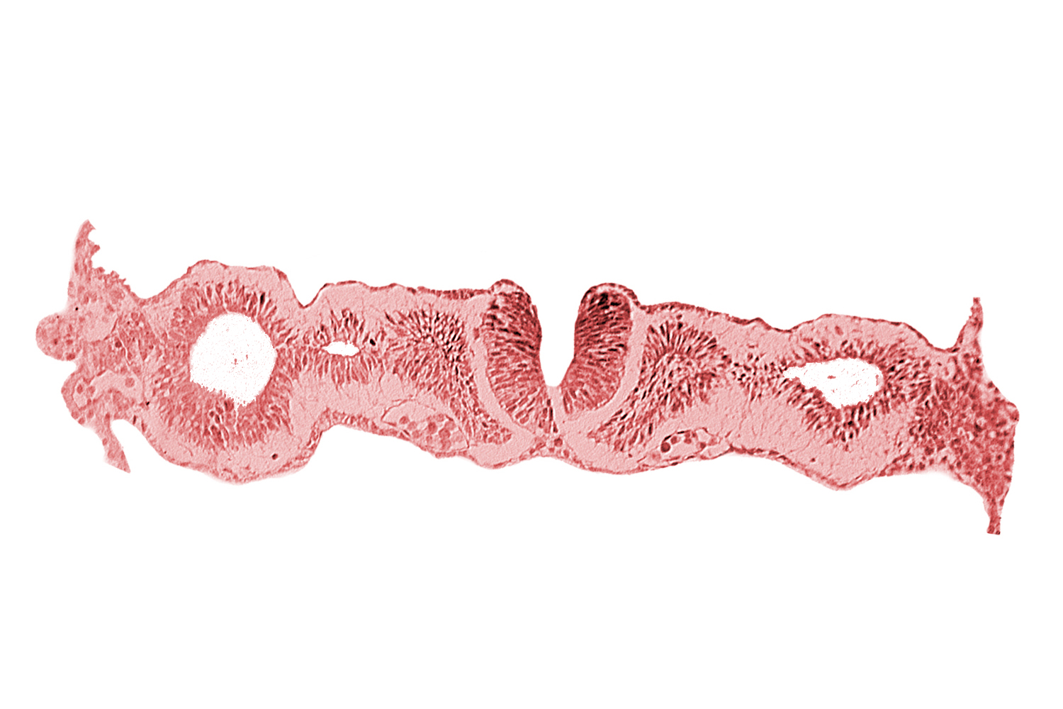 alar plate(s), basal plate, dorsal aorta, notochordal plate, primordial peritoneal cavity, somitocoel 1, sulcus limitans