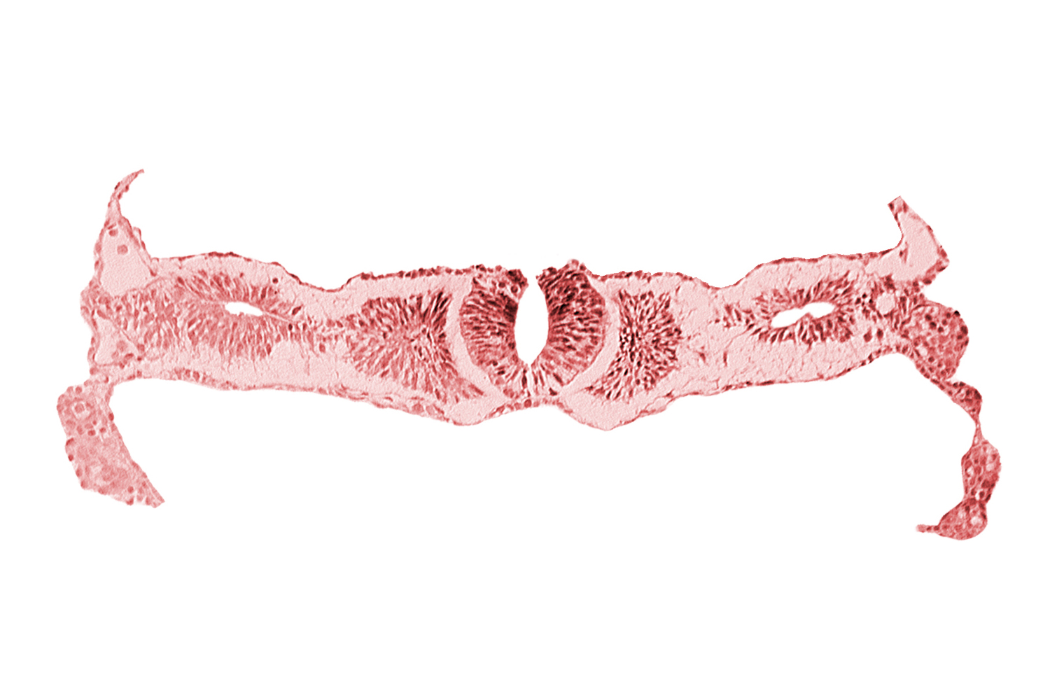 amnion, caudal edge of cephalic neuropore, neural fold [rhombencephalon (Rh. D)], notochordal plate, primordial peritoneal cavity, right umbilical vein, somite 2 (O-2), umbilical vesicle wall