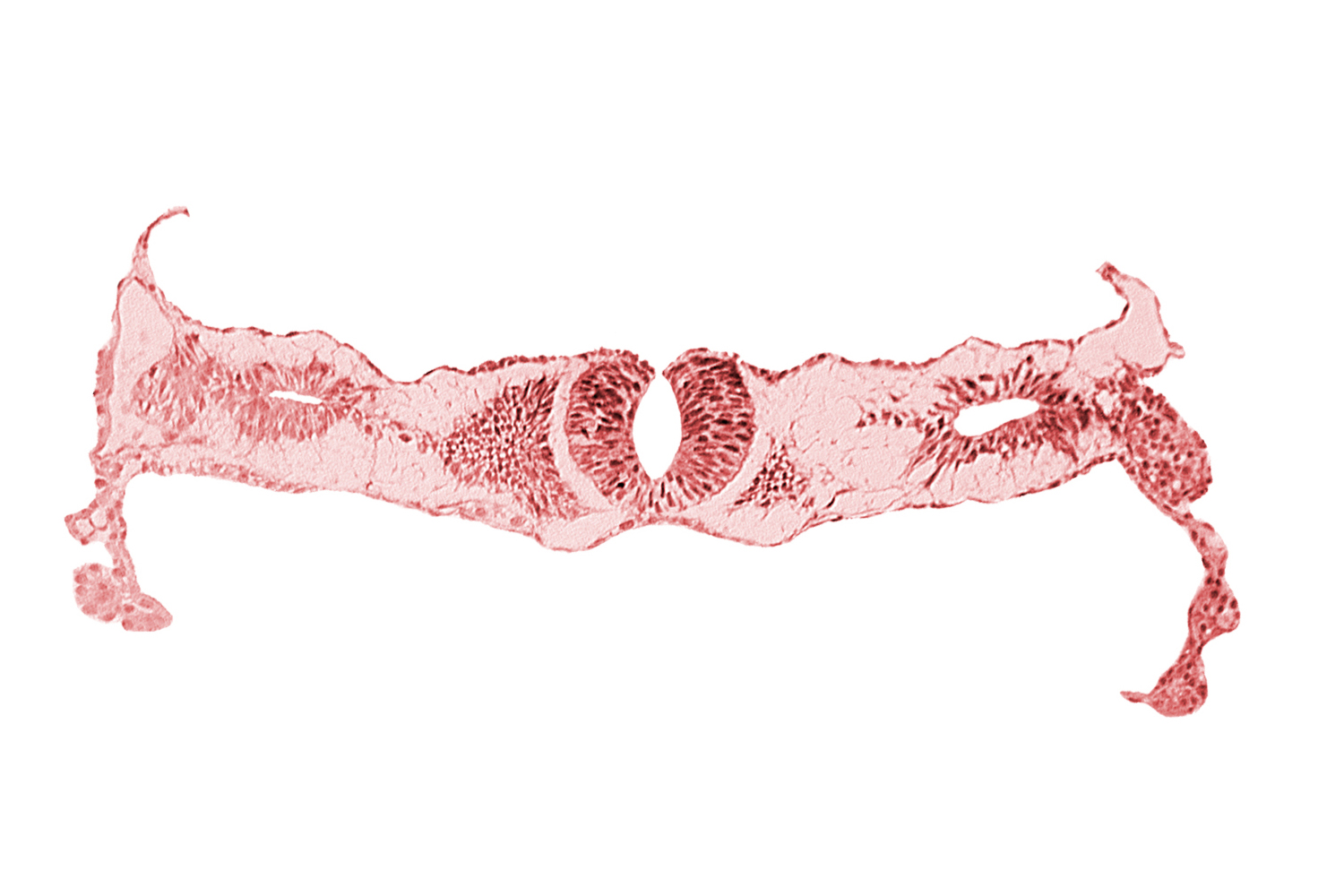 amnion, junction area of neural folds [rhombencephalon (Rh. D)], midgut, notochordal plate, primordial peritoneal cavity, somite 2-3 intersegmental region