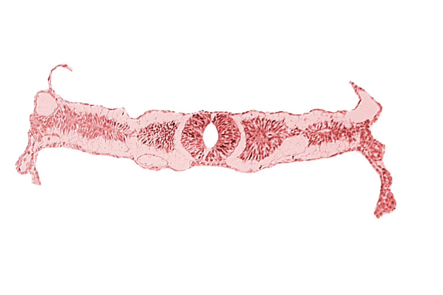amnion attachment, dorsal aorta, midgut, somite 3 (O-3), umbilical vesicle wall