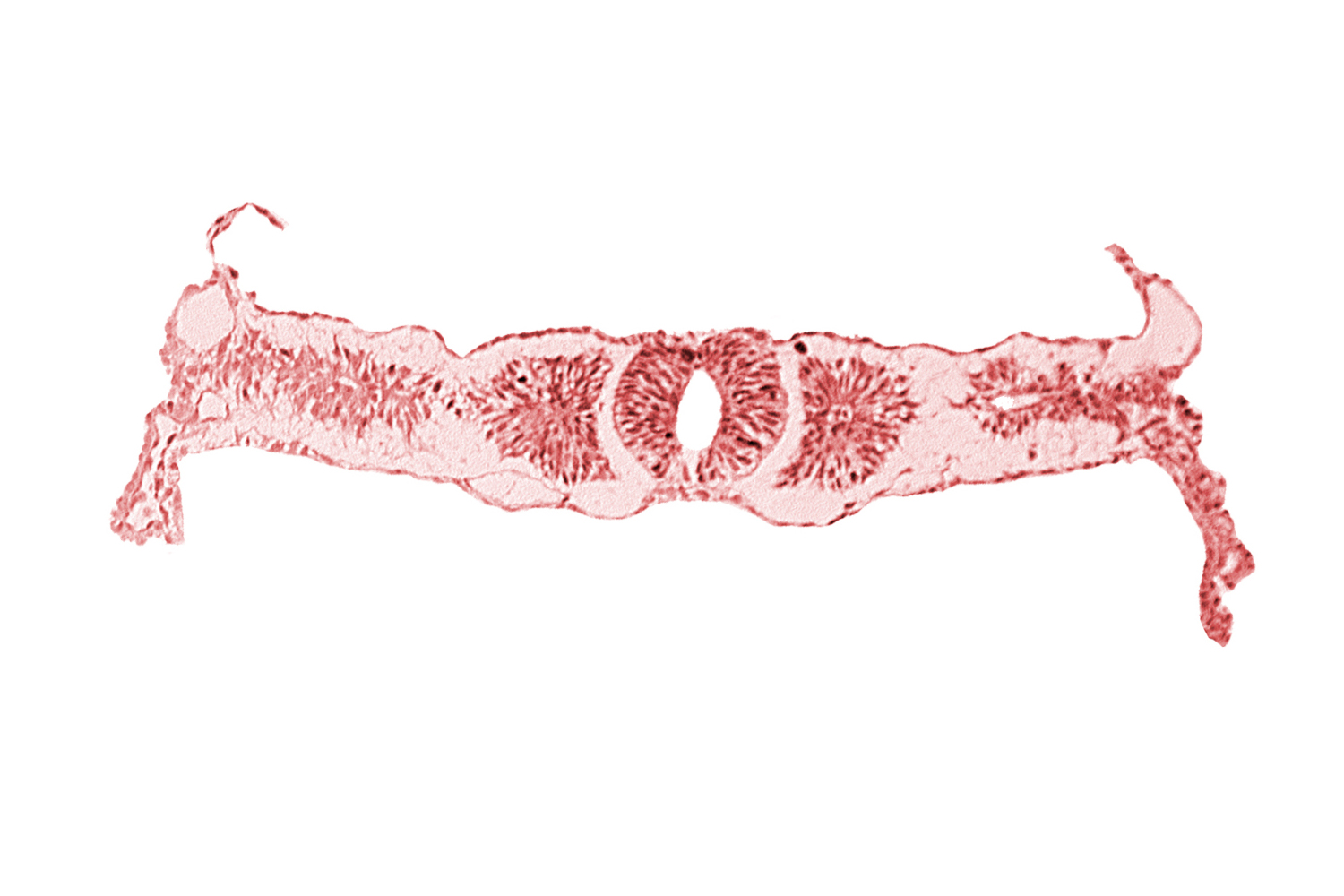 amnion attachment, dorsal aorta, endoderm, midgut, somite 3 (O-3), somitocoel 3, sulcus limitans, surface ectoderm, umbilical vesicle wall