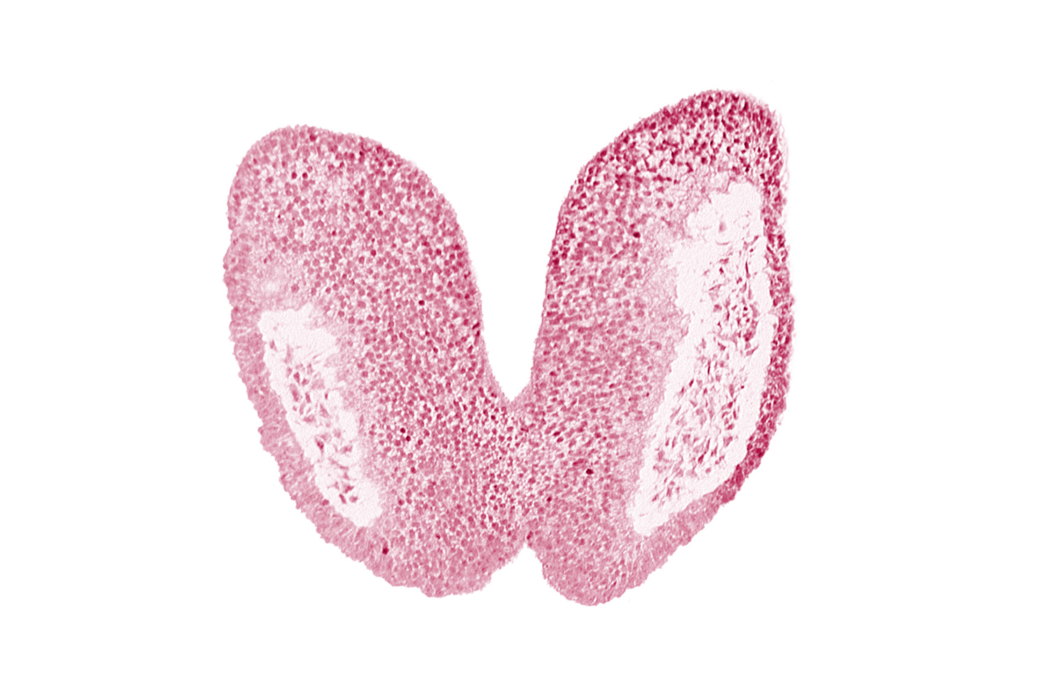 artifact space(s), chiasmatic plate (D1), head mesenchyme, junction of neural fold and surface ectoderm, neural fold [primordial diencephalon (D2)], neural fold [primordial telencephalon medium (T)], neural groove, optic nerve primordium (CN II) [primordial diencephalon (D1)], optic sulcus [primordial diencephalon (D1)], surface ectoderm of head, terminal notch