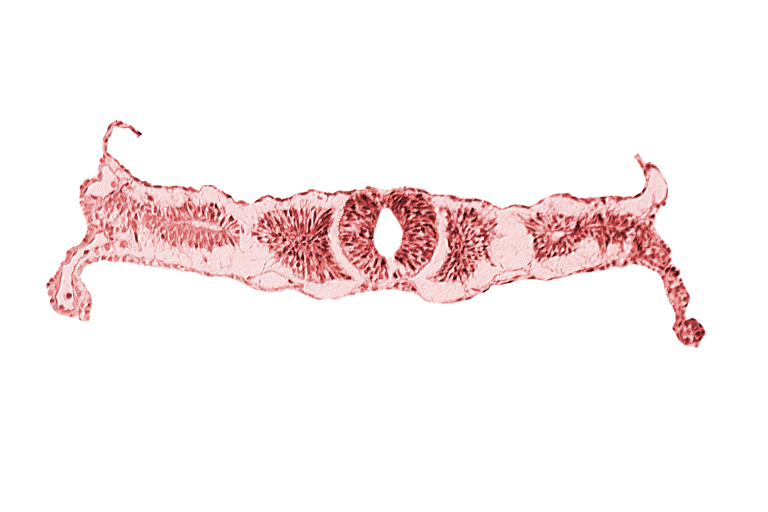caudal end of somite 3 (O-3), dorsal aorta, endoderm, midgut, sulcus limitans, surface ectoderm