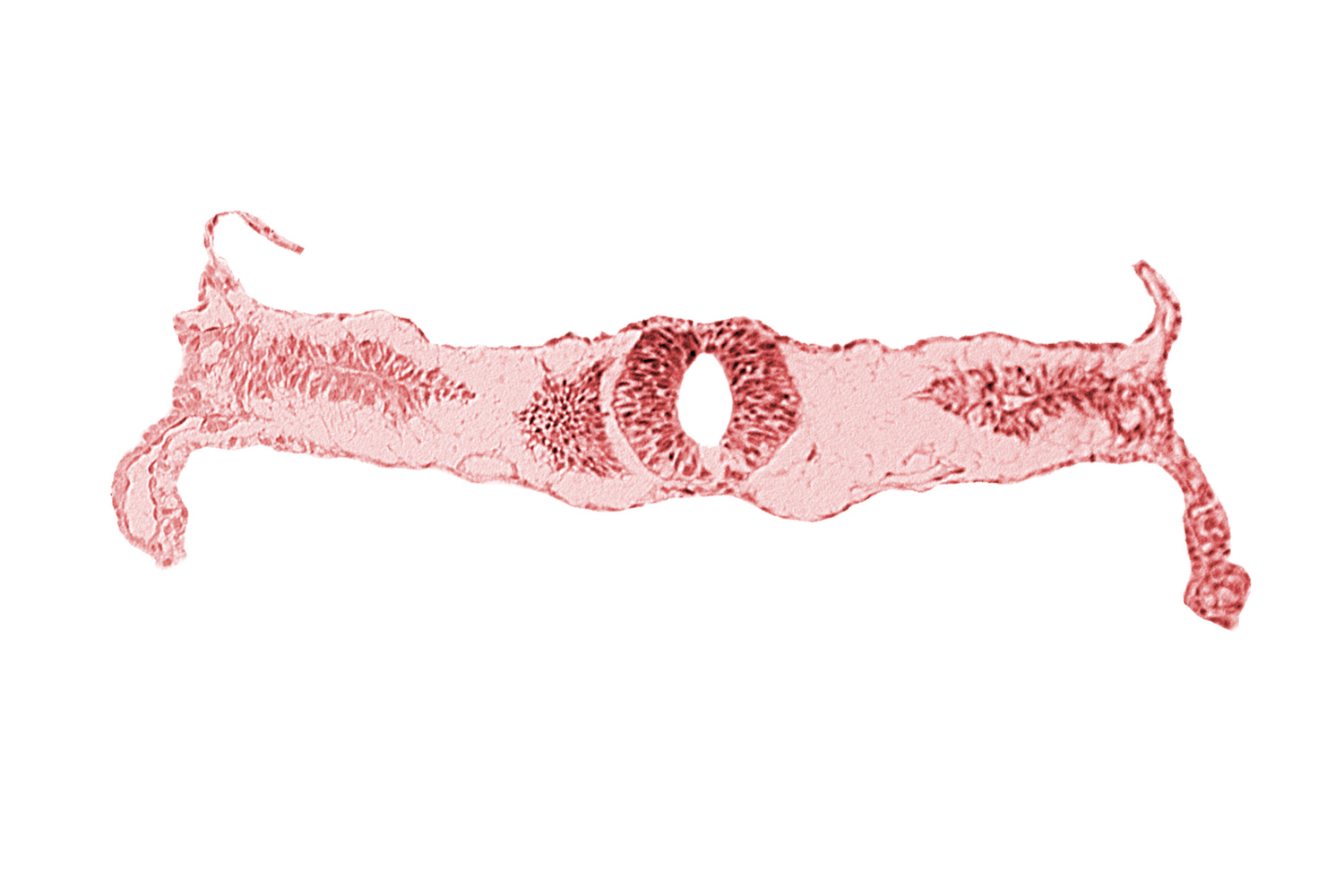 amnion attachment, amniotic cavity, extra-embryonic coelom, midgut, neural tube [rhombencephalon (Rh. D)], primordial peritoneal cavity, right umbilical vein, somite 3-4 intersegmental region, umbilical vesicle cavity, umbilical vesicle wall
