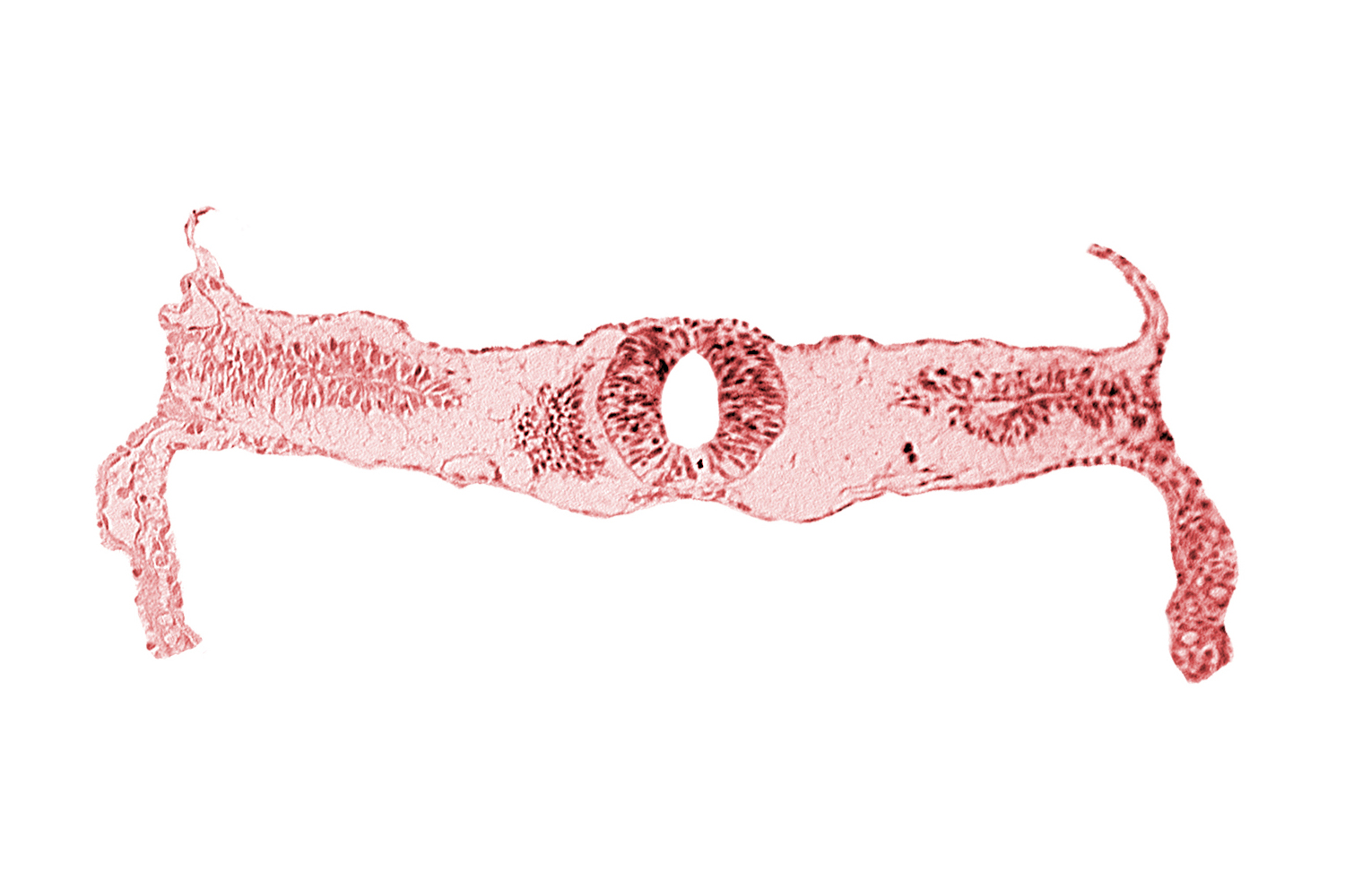 extra-embryonic coelom, midgut, neural tube [rhombencephalon (Rh. D)], somite 3-4 intersegmental region