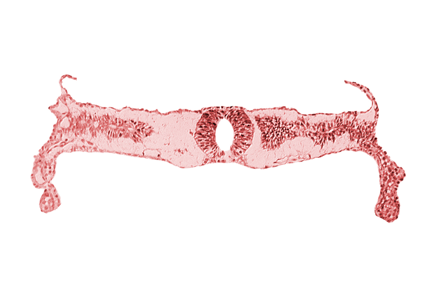 midgut, neural tube [rhombencephalon (Rh. D)], somite 3-4 intersegmental region