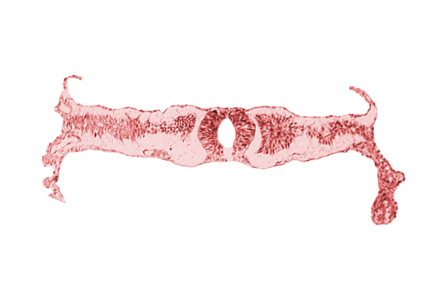 cephalic part of somite 4 (O-4), midgut, neural fold [rhombencephalon (Rh. D)], right umbilical vein