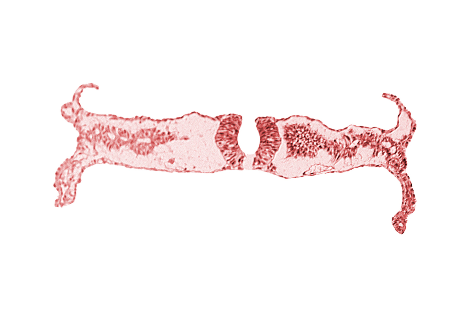 cephalic edge of caudal neuropore, cephalic part of somite 5 (C-1), dorsal aorta, midgut, neural fold (spinal cord), primordial peritoneal cavity