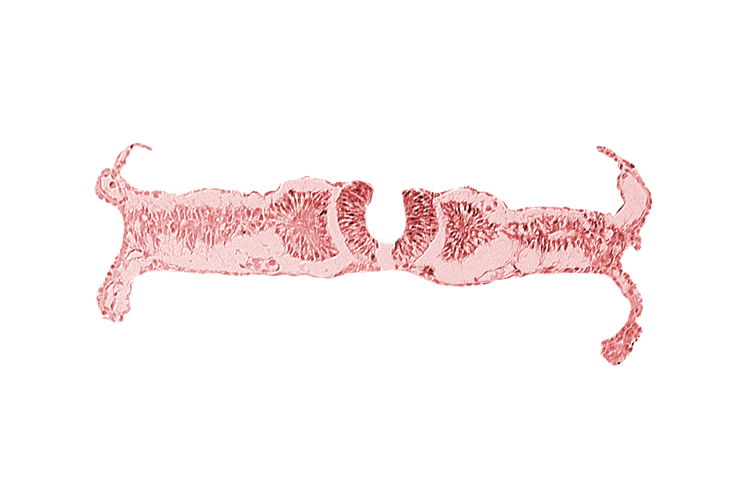 dorsal aorta, somite 5 (C-1)