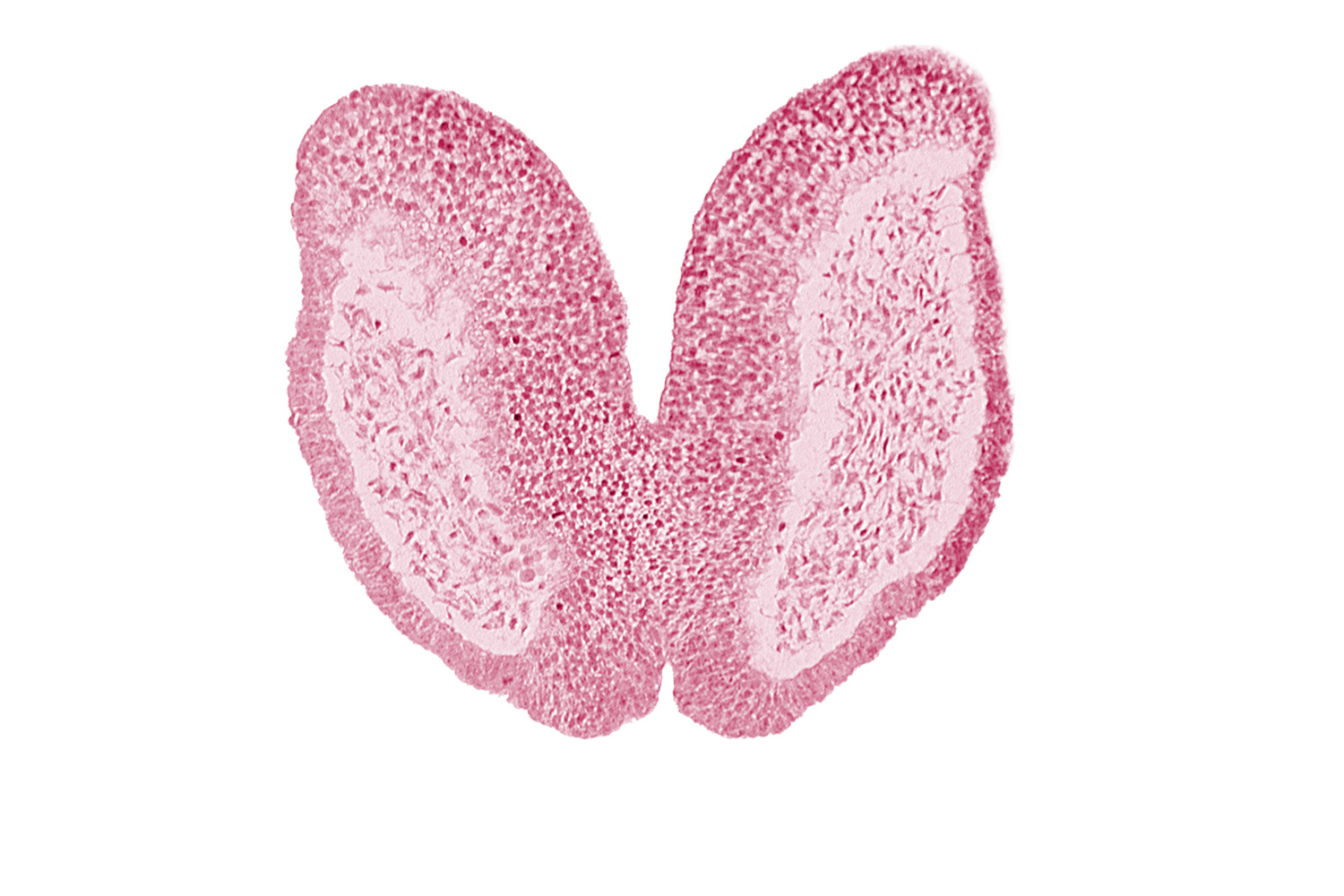 amniotic cavity, artifact space(s), cephalic neuropore, chiasmatic plate (D1), head mesenchyme, junction of neural fold and surface ectoderm, maxillary prominence of pharyngeal arch 1, neural fold [primordial diencephalon (D2)], neural fold [primordial telencephalon medium (T)], neural groove, surface ectoderm of head, terminal notch