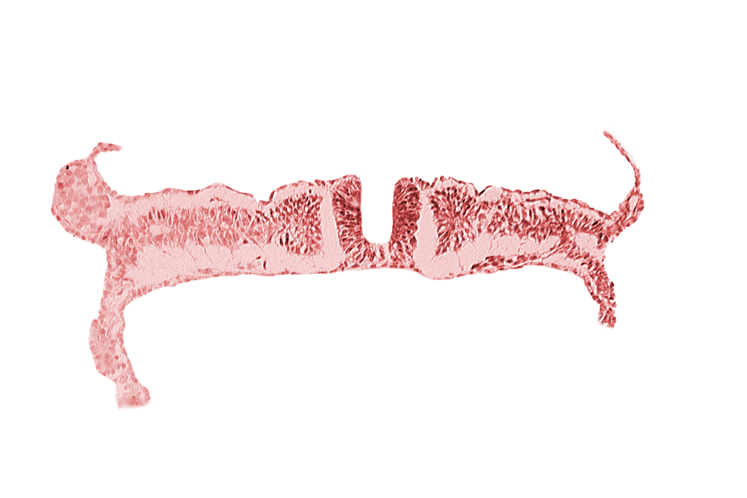 caudal neuropore, communication between primordial peritoneal cavity and extra-embryonic coelom, dorsal aorta, extra-embryonic coelom, primordial peritoneal cavity, somite 7 (C-3), somitocoel 7