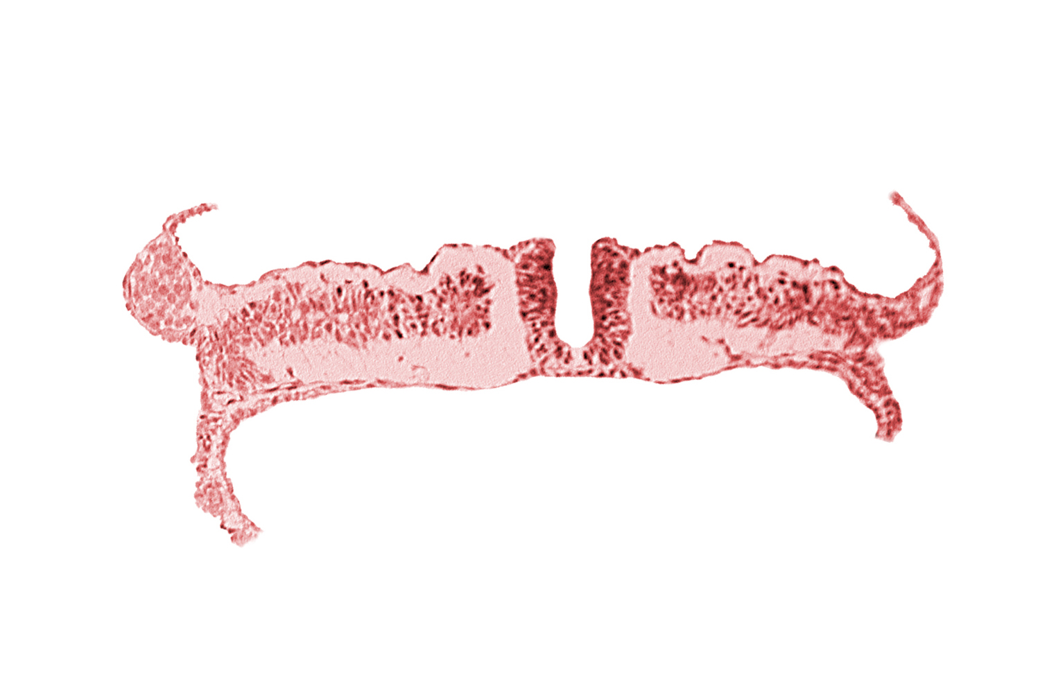 amnion attachment, amniotic cavity, caudal edge of somite 7 (C-3), caudal neuropore, endoderm, extra-embryonic coelom, extra-embryonic mesoderm, midgut, umbilical vesicle cavity, umbilical vesicle wall