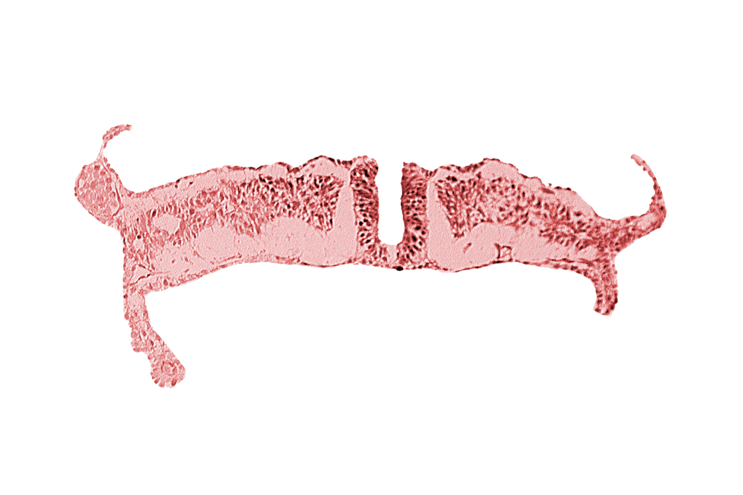 amnion attachment, amniotic cavity, dorsal aorta, neural fold, umbilical vesicle cavity, umbilical vesicle wall